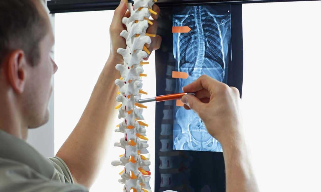 curved spine scoliosis treatment